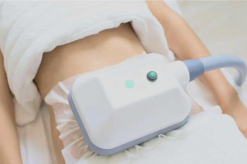 How Fat Freezing and HIFU Work Together? 3 advantages to combining Fat Freezing and HIFU York