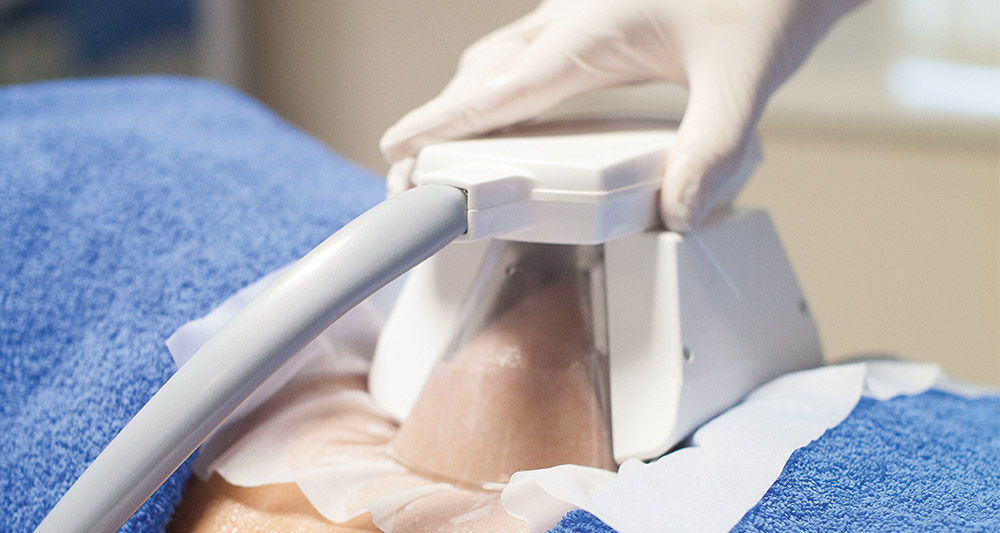 How Fat Freezing and HIFU Work Together? 2 Multiple Areas in One Session HIFU and Fat Freezing York