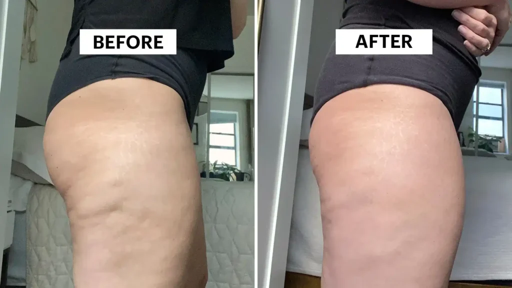 Do Toning Exercise York Really Tackle Cellulite?