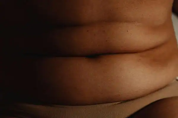 The Hidden Connection: How Stress Shapes Your Fitness and Body Composition 3 image of what stress can do on the stomach area and how Lipo 360 York can help to change your body shape.